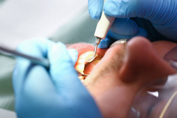 Best Cosmetic Emergency Dentistry in Miramar, FL
