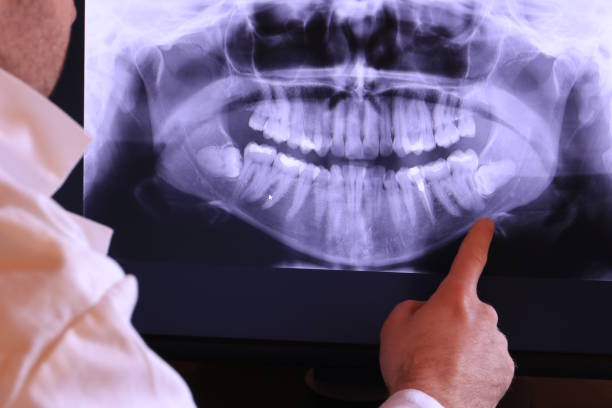 Best Emergency Gum Treatment in Miramar, FL